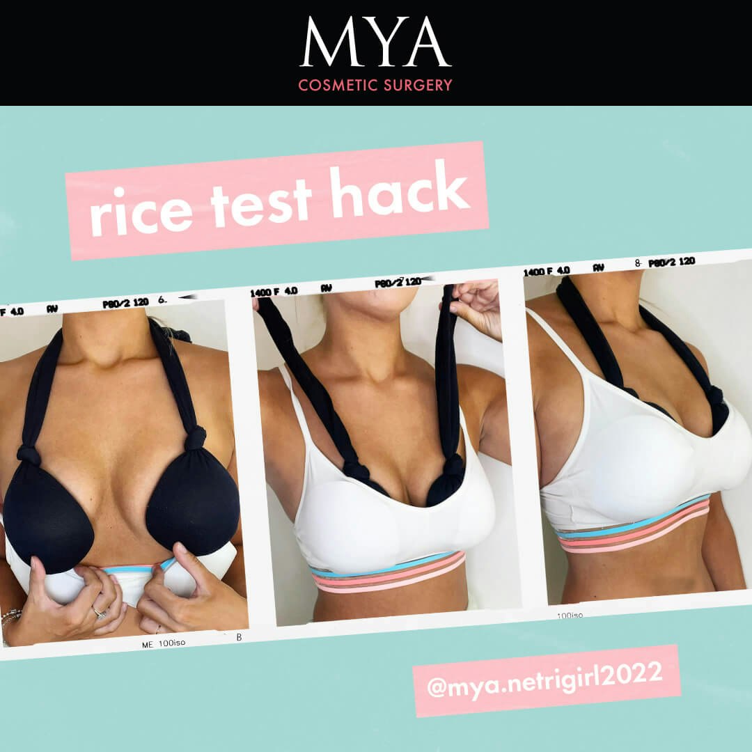 What is the Implant Rice Test MYA Cosmetic Surgery