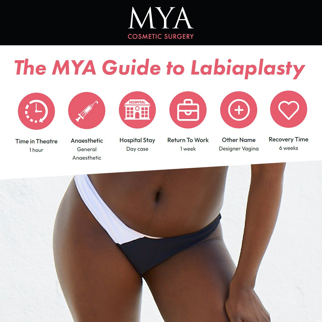 labiaplasty surgery guide - MYA Cosmetic Surgery
