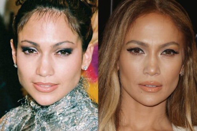 Has Jennifer Lopez had Cosmetic Surgery? | MYA Cosmetic Surgery