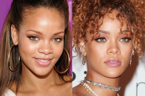 Has Rihanna had Cosmetic Surgery MYA Cosmetic Surgery