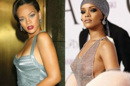 Has Rihanna had Cosmetic Surgery MYA Cosmetic Surgery