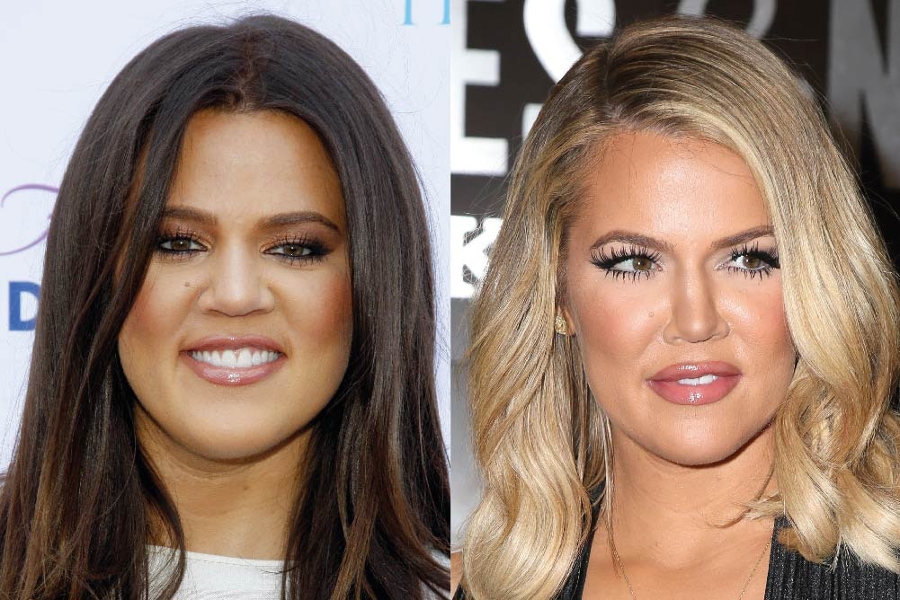 Has Khloe Kardashian Had Cosmetic Surgery? | MYA Cosmetic Surgery