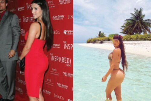 Has Kim Kardashian had Cosmetic Surgery?