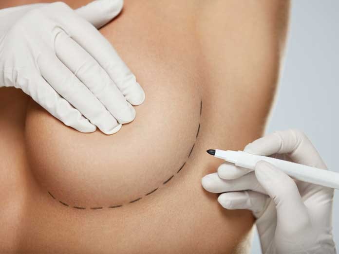 Potential Risks Complications with Breast Surgery MYA Cosmetic