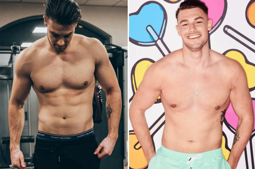 Has Love Island's Andrew had cosmetic surgery?