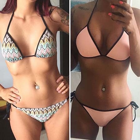 Cosmetic Surgery - Before and After