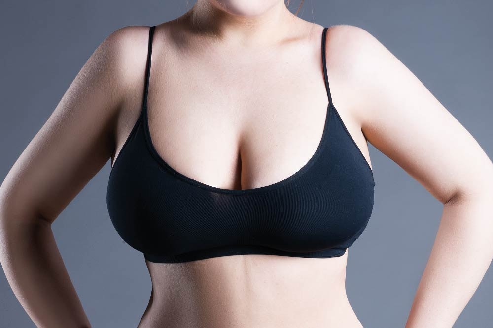 Breast Reduction Surgery at MYA