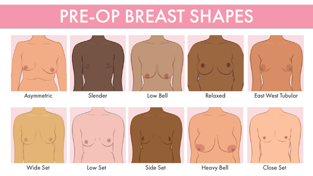 different breast shapes