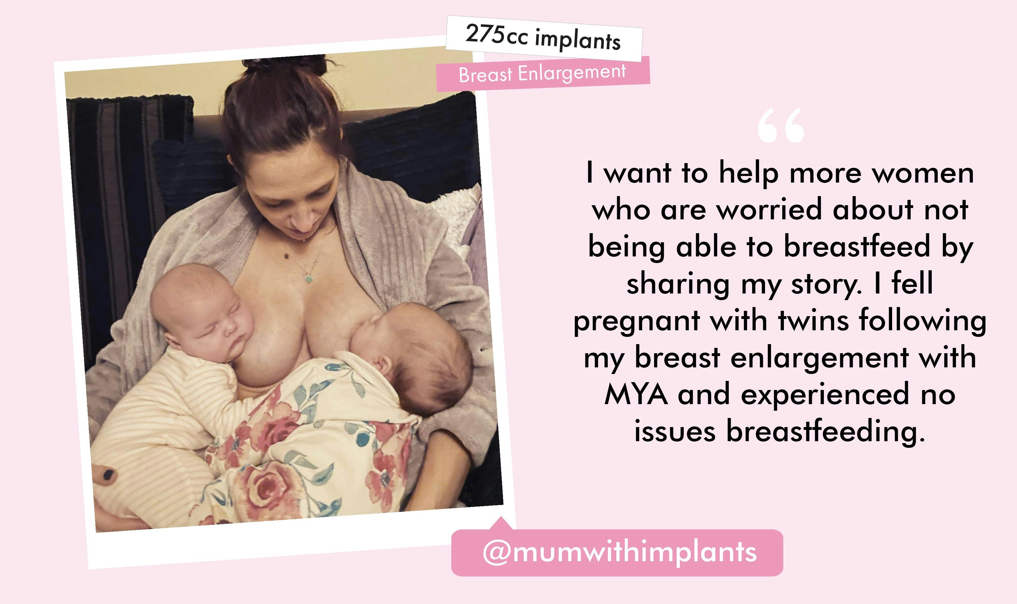 Can you breastfeed after a breast enlargement? | MYA Cosmetic Surgery Can you breastfeed after a breast enlargement? | MYA Cosmetic Surgery