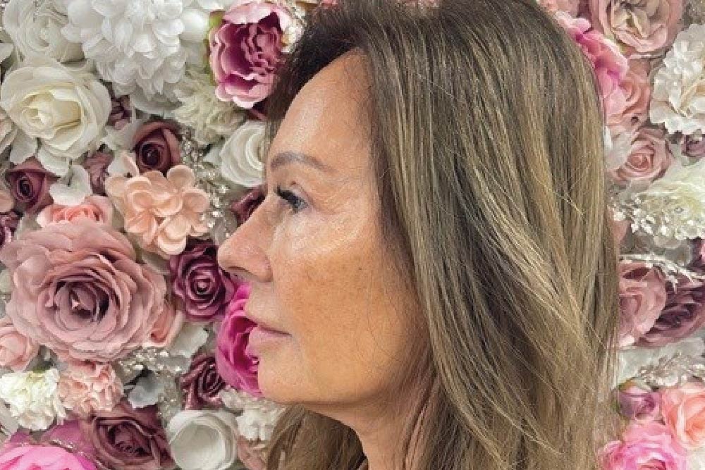 Facelift - MYA Cosmetic Surgeons