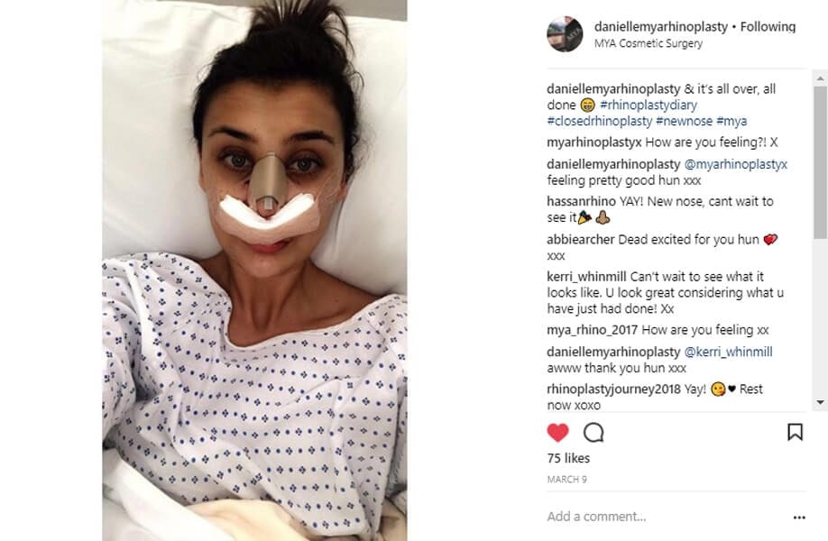 daniellemyarhinoplasty Instagram Journey