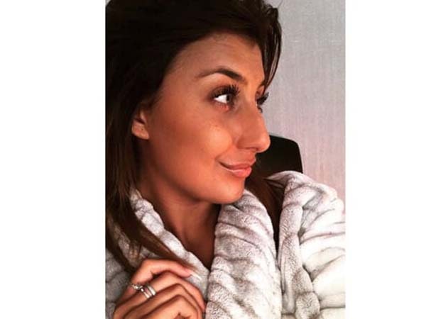 daniellemyarhinoplasty Instagram Journey