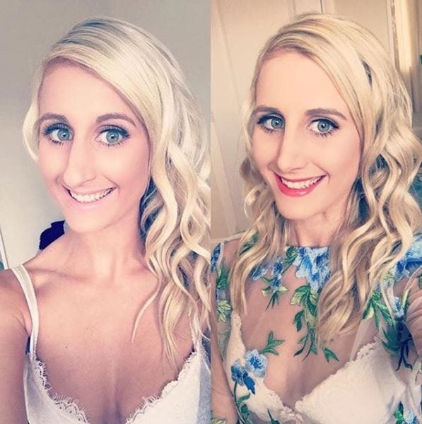 laurasrhinodiary Instagram Journey