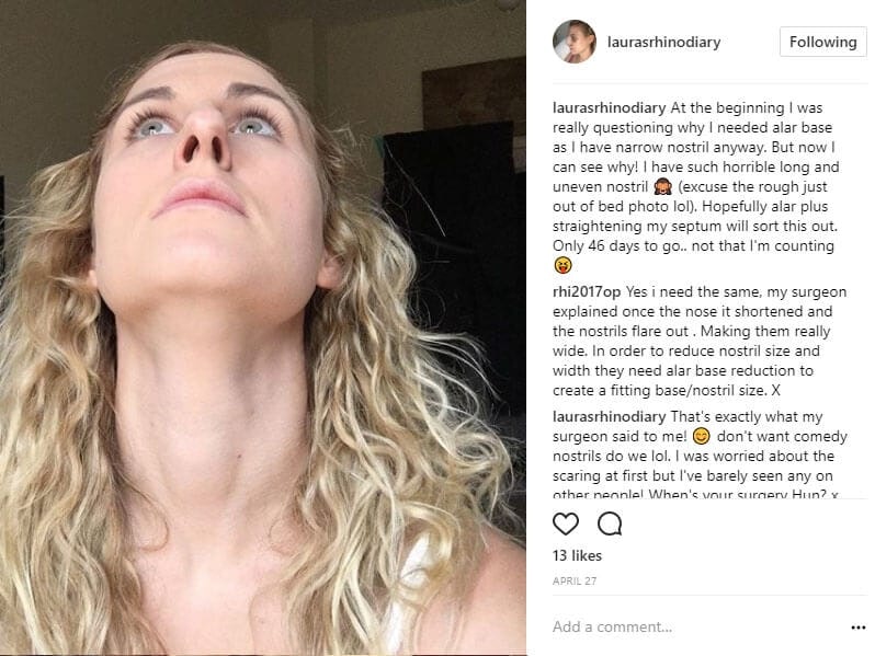 laurasrhinodiary Instagram Journey