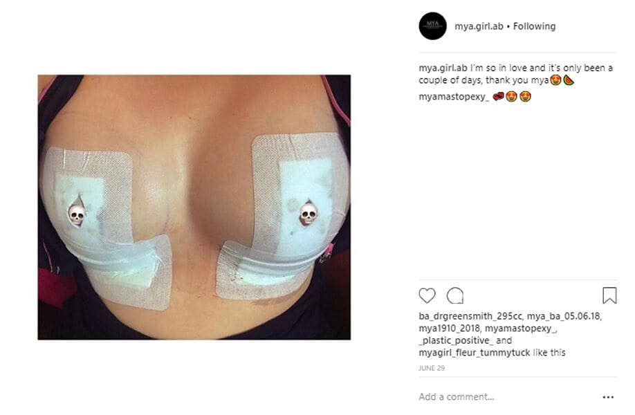 mya-girl-ab Instagram Journey