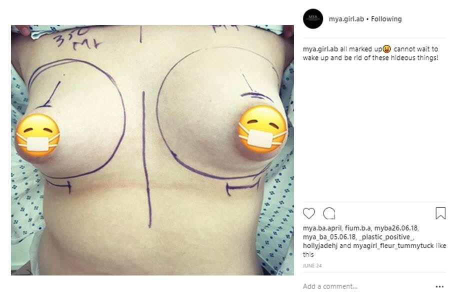 mya-girl-ab Instagram Journey