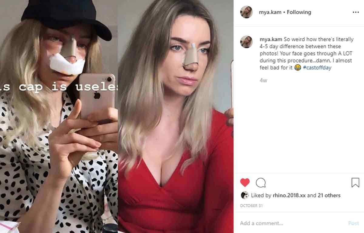 mya-kam Instagram Journey