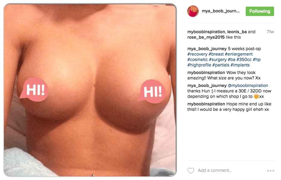 mya_boob_journey Instagram Journey