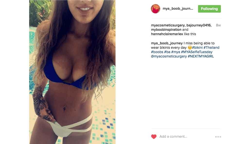 mya_boob_journey Instagram Journey