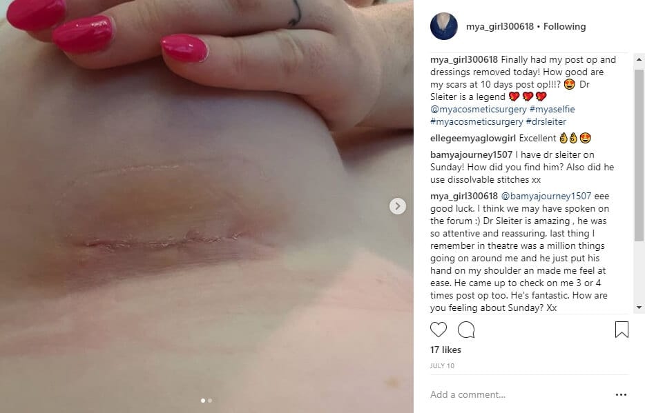 mya_girl300618 Instagram Journey