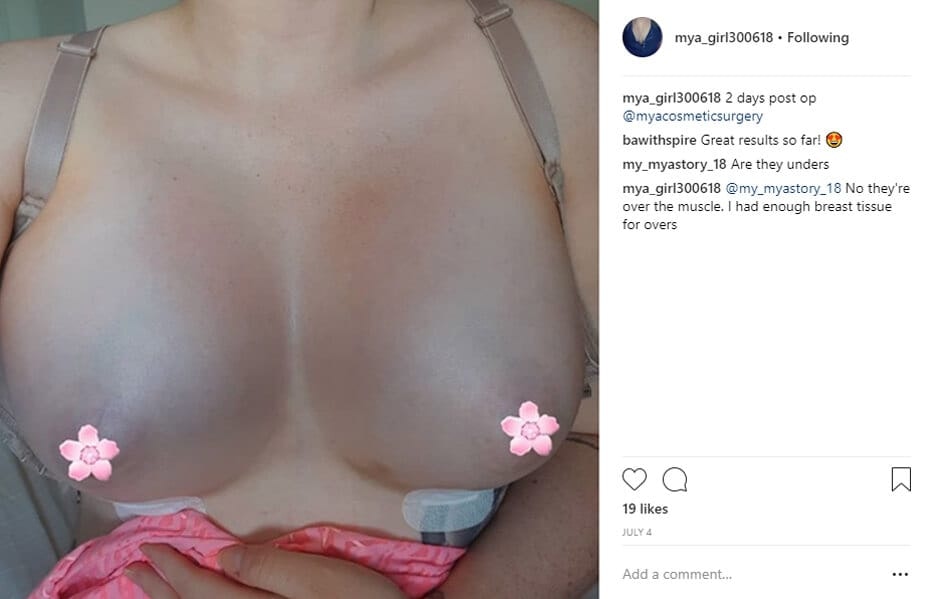 mya_girl300618 Instagram Journey