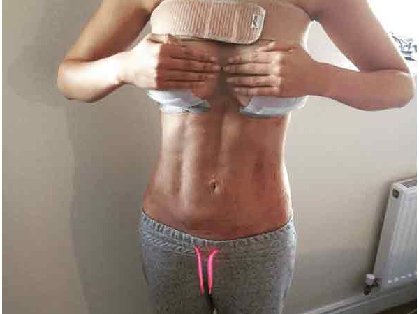 mya_reaug_vaser_journey Instagram Journey