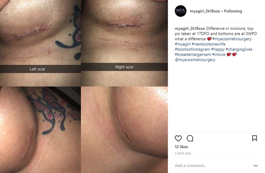 myagirl_2k18xox Instagram Journey
