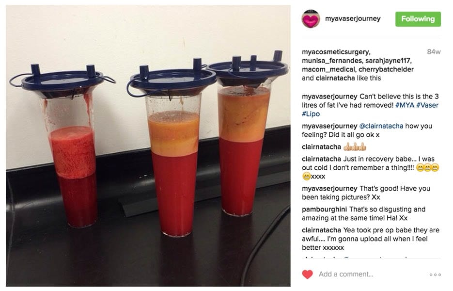 myavaserjourney Instagram Journey