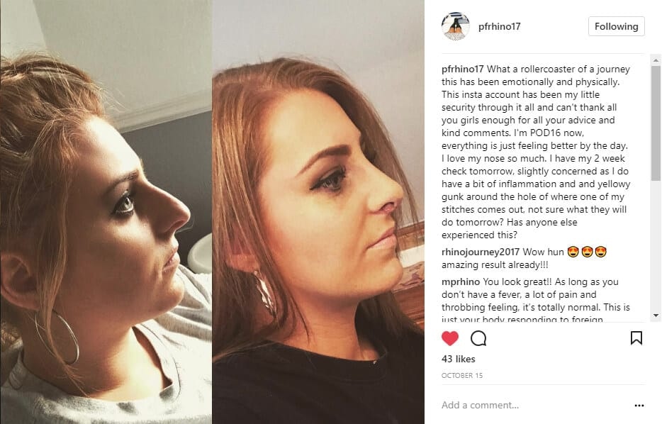 pfrhino17 Instagram Journey