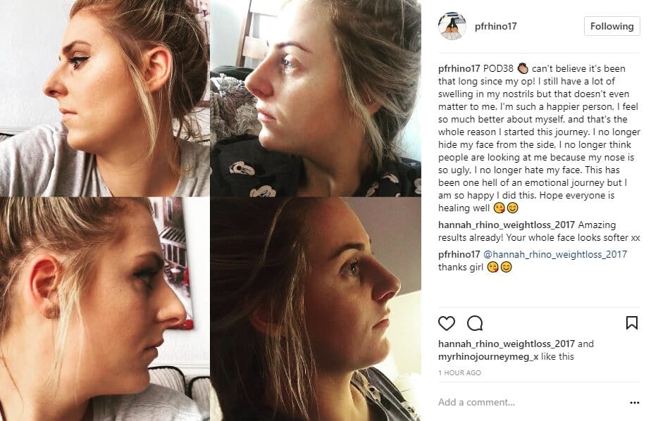 pfrhino17 Instagram Journey