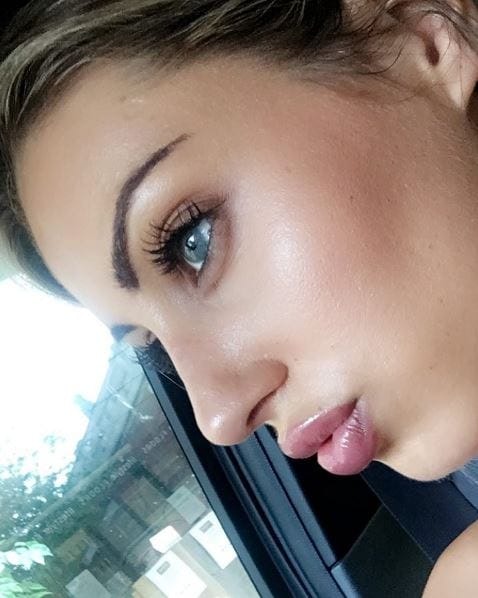 rhinoplasty2017x Instagram Journey