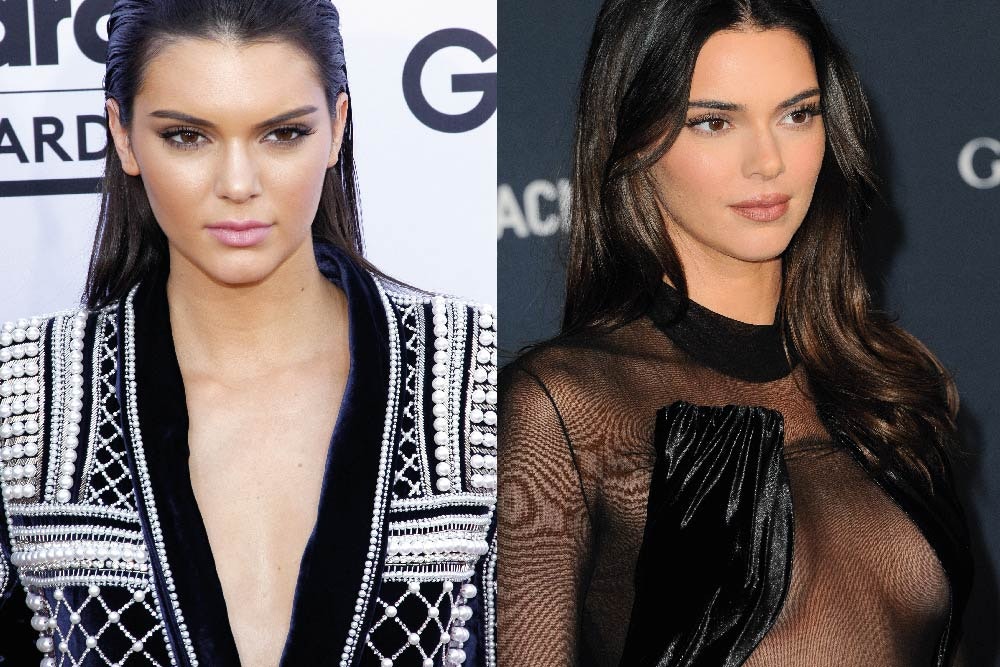 Has Kendall Jenner had a boob job MYA Cosmetic Surgery