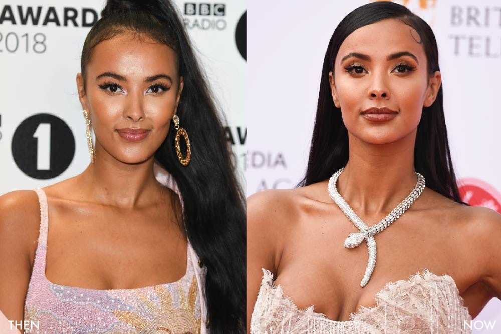 Has Maya Jama had cosmetic surgery MYA Cosmetic Surgery