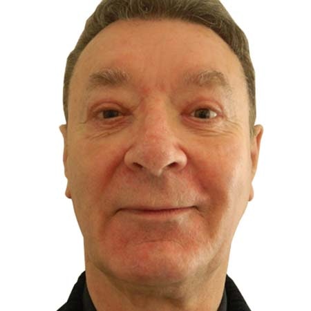 Eye bag male patient 2 - post-op