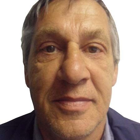 Eye bag male patient 1 - post-op